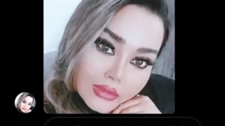 عکس ارسالی زیباجوی عزیزم بعدداز ۲مـاه