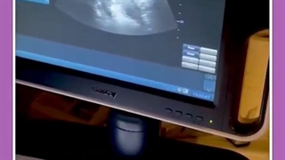 درمان ناباروری و حس زیبای مادر شدن