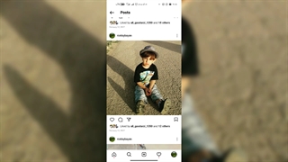 حسن سهرابی لیفت گردنایمپلنت دندان