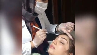 بوتاکس پیشانی