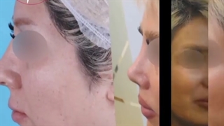 ❌لطفا تا انتها ببینیـد❌