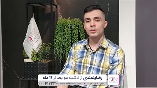 کاشت مو با بروزترین تکنیک دنیا