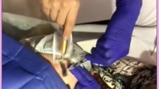 دلایل ریزش ابرو و راه های درمان آن