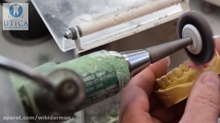 نحوه ساخت دندان مصنوعی ژله ای با کیفیت