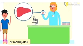 چاقی و کبد چرب