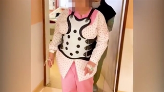 تنگی کانال نخاعی و جابه جایی مهره ها