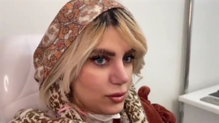 فیلم عمل بینی پهن و گوشتی