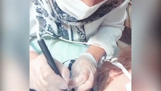 فیلم واقعی برداشتن خال