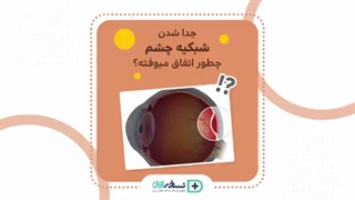 جدا شدن شبکیه از چشم - داروخانه اینترنتی نسخه اول - داروخانه آنلاین نسخه اول