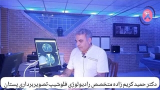ماموگرافی سینه | ماموگرافی دکتر کریم زاده لیفت گردنایمپلنت دندان