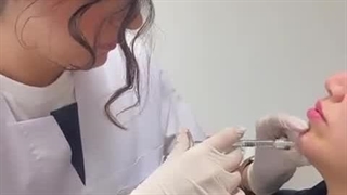 فیلم تزریق ژل چانه + تخفیف ✅