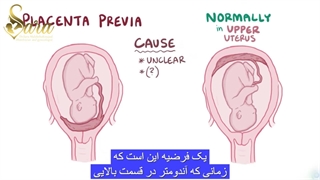 جفت سر راهی