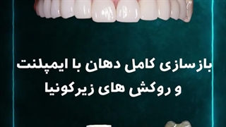دکتر عباس گشاده رو. متخصص ایمپلنت زاویه سازی صورت