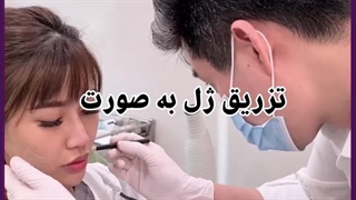 تزریق ژل به صورت