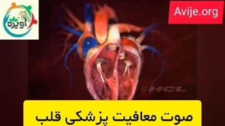 تپش قلب و معافیت سربازی