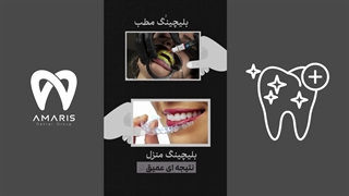 هوم بلیچینگ یا آفیس بلیچینگ