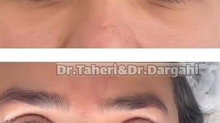 دکتر مصطفی طاهری لیزر موهای زائد