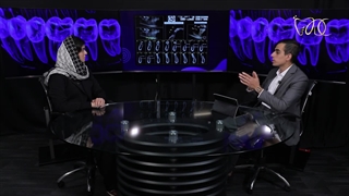 همه چیز درباره ایمپلنت دندان (پارت ۲)