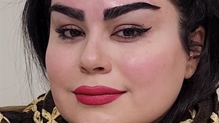 کاشت ابرو در کلینیک آوینا