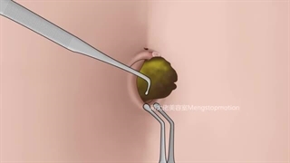 *Hamonium Asmr 2024*درمان بوی جوش ناف شکم-قسمت بیست و چهارم