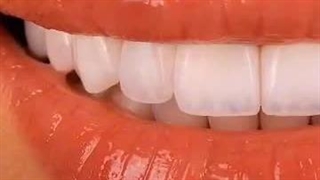 طراحی لبخند دندان ها - دکتر امیرحسین ابوالبشری پالپوتومی