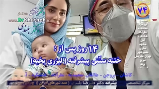 بهترین فیلم ختنه کرج تهران