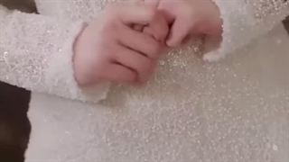 دختر روستایی وارث است قسمت‌4 جراحی پف زیر چشم